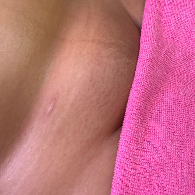 Brazilian 1 Year Wax Package at SkynByGia in raleigh, NC